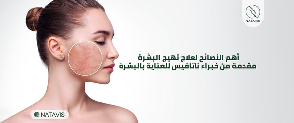 Effective Sensitive Skin Irritation Treatment Tips