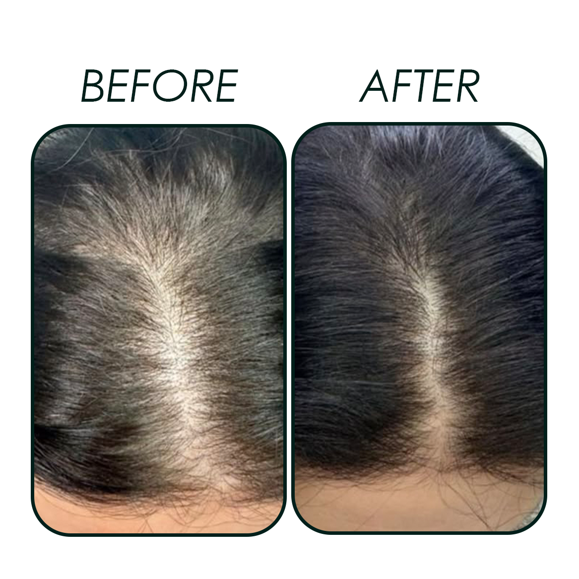Scalp Therapy Bundle