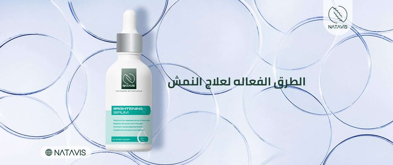 4 Effective Ways to Treat Facial Freckles Natavis