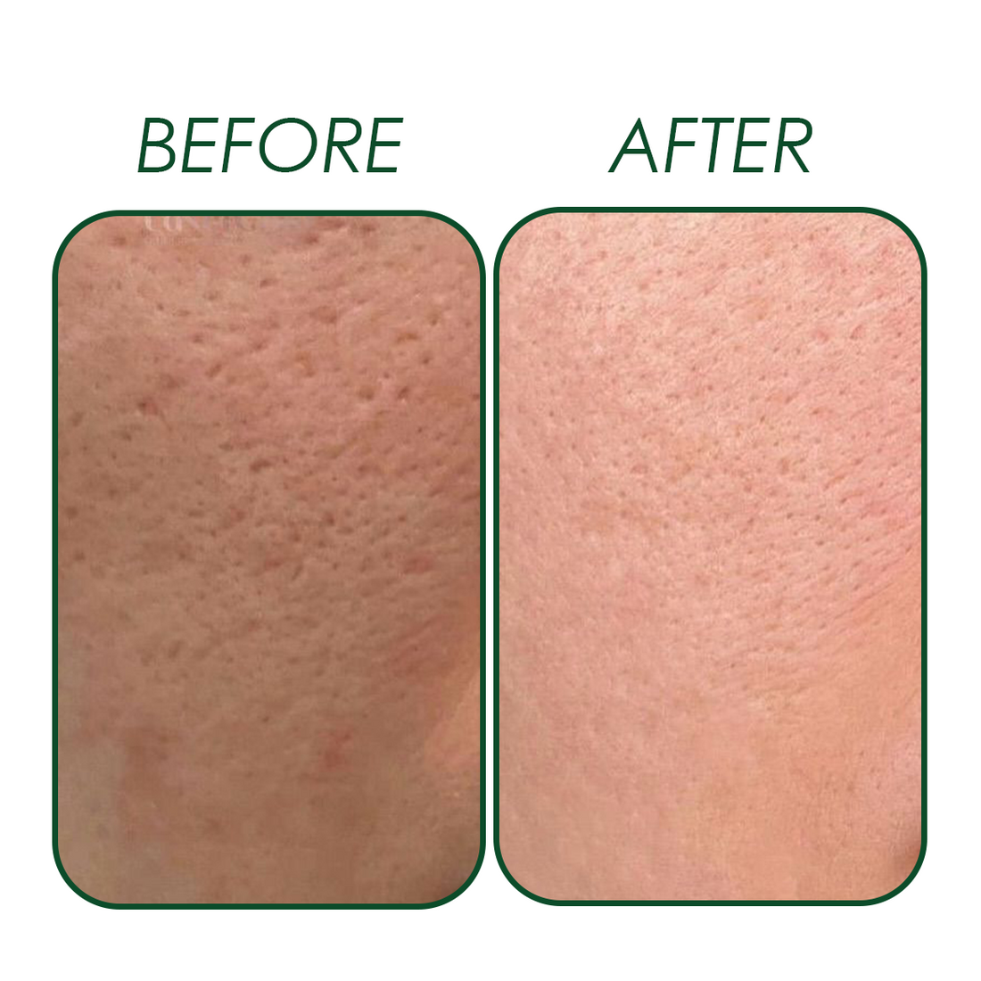 THE SKIN RESET