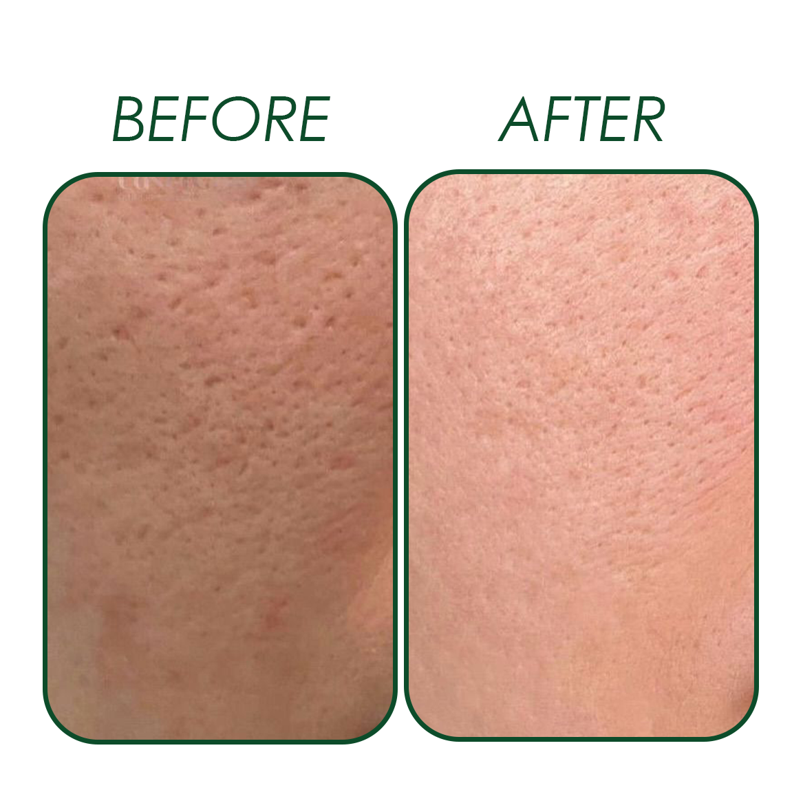 THE SKIN RESET