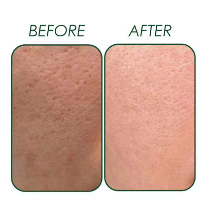 THE SKIN RESET