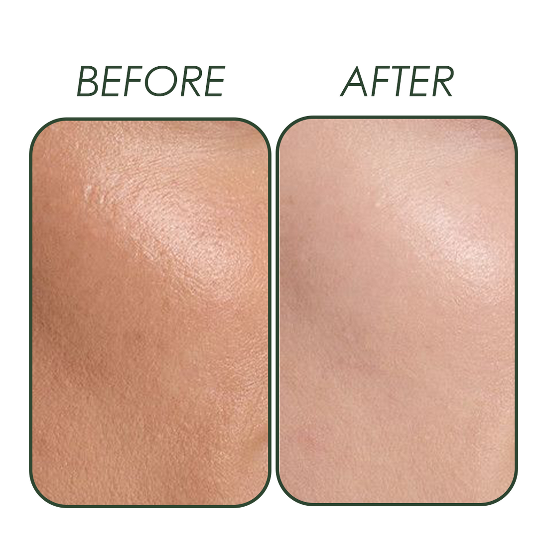 Super Brightening Routine