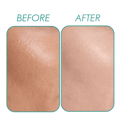 Brightening Serum (Alpha Arbutin 2% Serum) Natavis