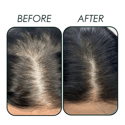Hair Booster Spray 100ml Natavis