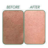 Niacinamide (Vitamin B3) Serum Natavis
