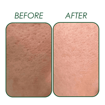 Niacinamide (Vitamin B3) Serum Natavis