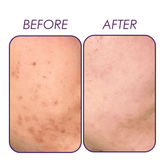 Retinol 1% serum (night serum) Natavis