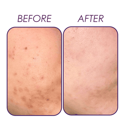 Retinol 1% serum (night serum) Natavis