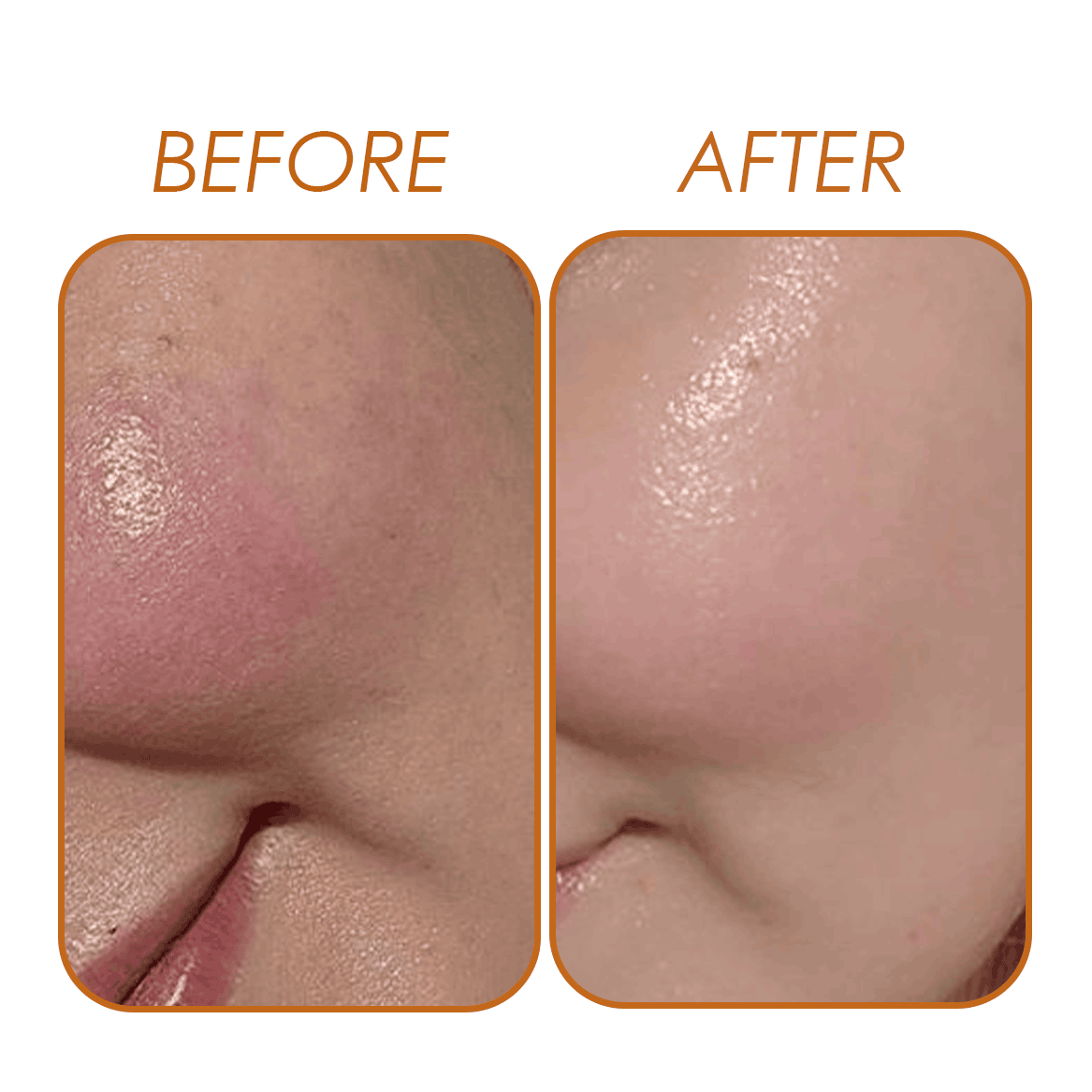 Vitamin C Serum Natavis