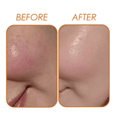 Vitamin C Serum Natavis