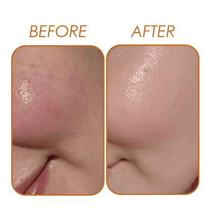 Vitamin C Serum Natavis