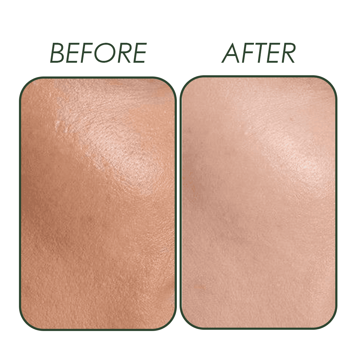 White Advanced Cream Natavis